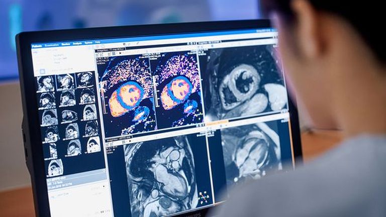 Philips meldt probleem met softwareconfiguratie